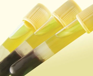 Unveiling the Role of Gold Top Tubes in Modern Clinical Chemistry